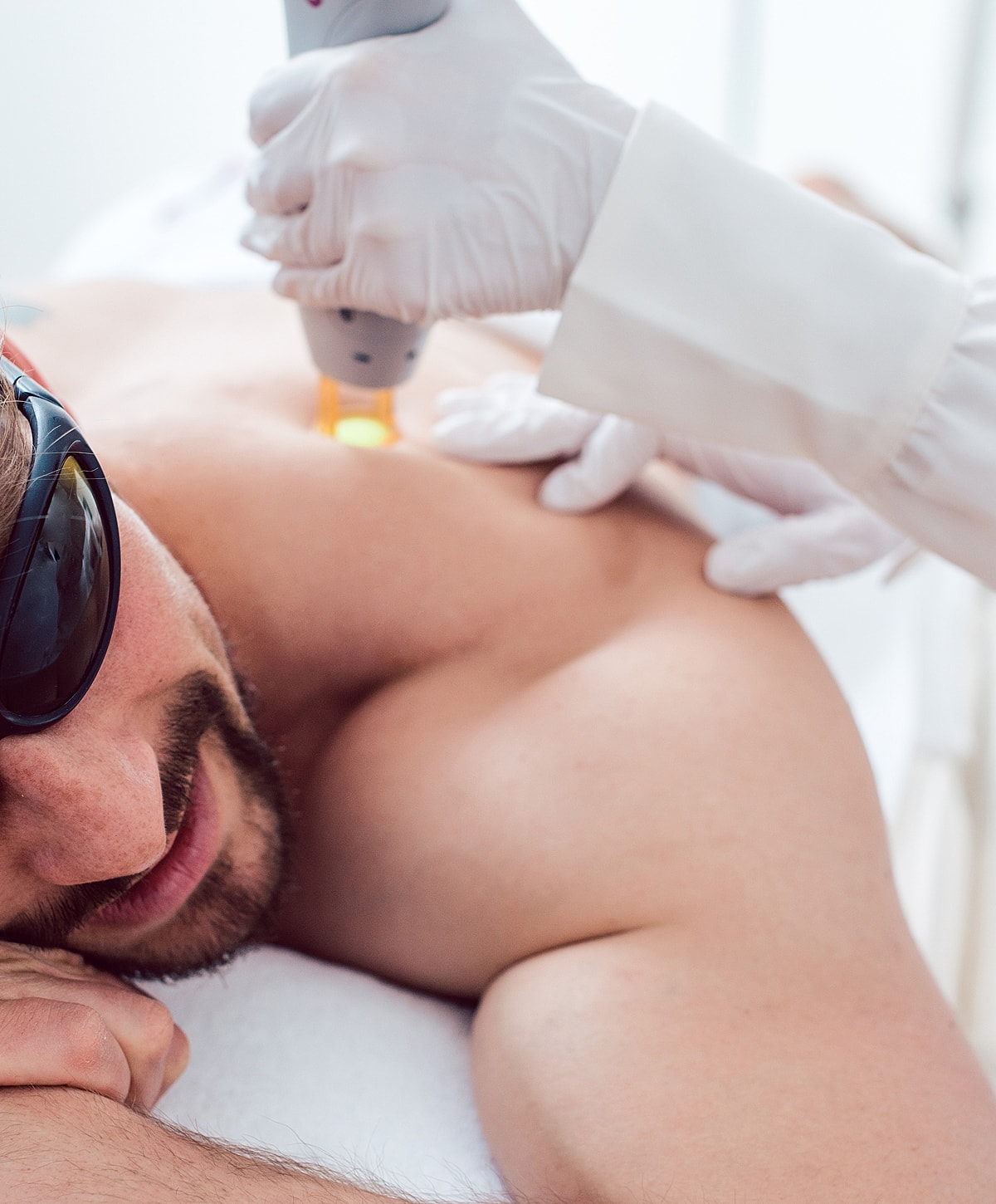 Abuja Laser Hair removal for Men model with curly hair.