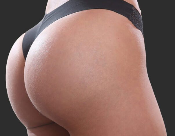 Does Vacuum Butt Lift Work? 8 Things To Know About Vacuum Therapy For  Buttocks